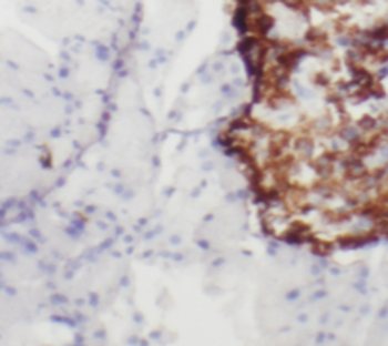 RAB3A Antibody