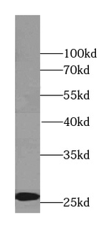 RAB3C specific Rabbit Polyclonal Antibody