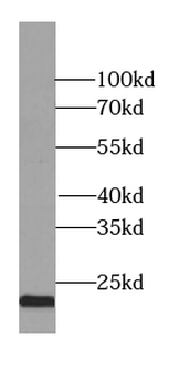 RAB9A Specific Rabbit Polyclonal Antibody