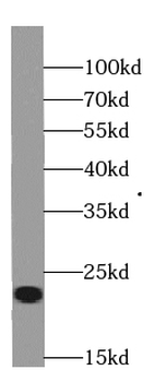 RBBP9 Antibody