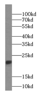 RBBP9 Antibody
