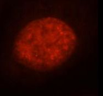 RBM15 Antibody