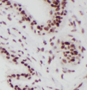 RBM15 Antibody