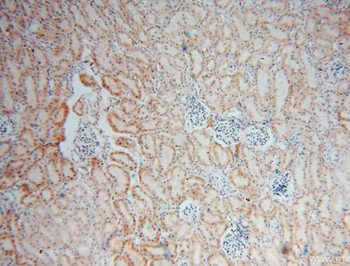 RNLS Mouse Monoclonal Antibody