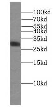 RIMS4 Antibody