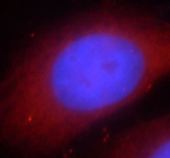 RIPK1 Antibody
