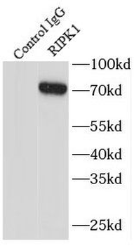 RIPK1 Antibody