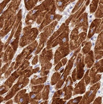 RIPK1 Antibody