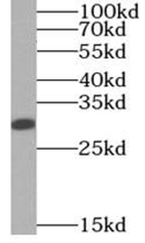 RNASET2 Antibody