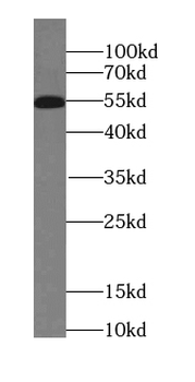 ROBO3 Antibody