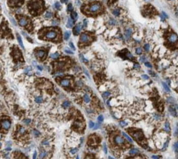 ROBO3 Antibody