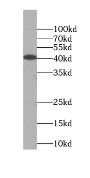 RRP36 Rabbit Polyclonal Antibody