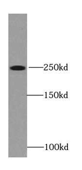 RYR2 Antibody