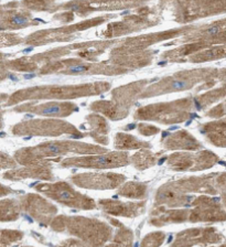 RYR2 Antibody