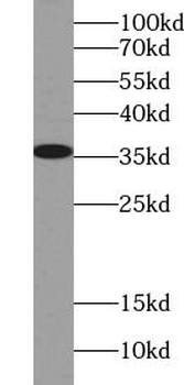 S1 tag Mouse Monoclonal Antibody