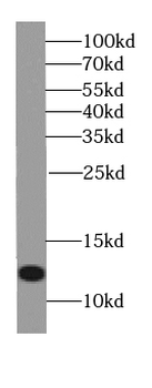 S100A11 Antibody