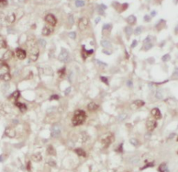 S100A11 Antibody