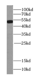 RPS6KB2 Antibody