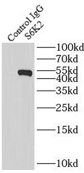 RPS6KB2 Antibody