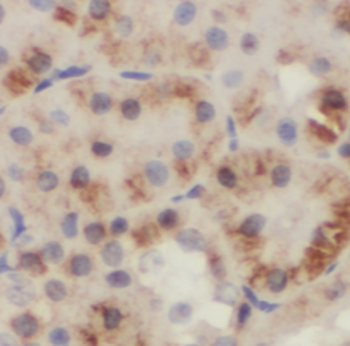 RPS6KB2 Antibody