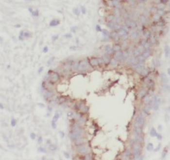 EXOC2 Antibody