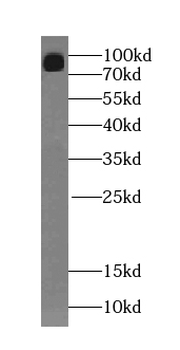 SENP5 Antibody