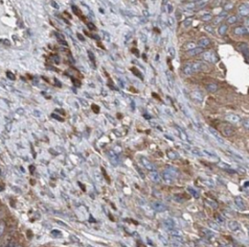 SEPTIN11 Antibody