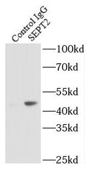SEPTIN2 Antibody