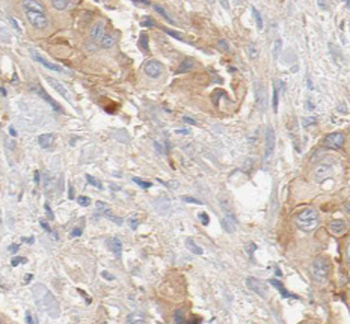 SEPTIN2 Antibody