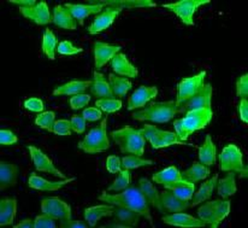 SEPTIN2 Antibody