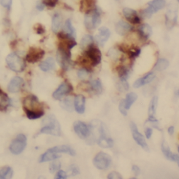 SEPTIN5 Antibody