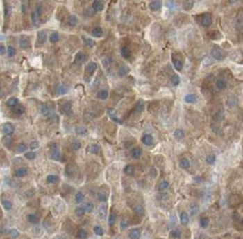 SEPTIN8 Antibody