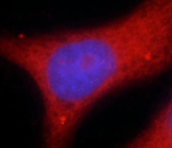 SEPTIN9 Antibody
