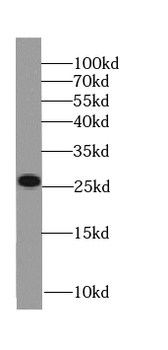 APCS Mouse Monoclonal Antibody