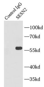 SESN2 Antibody