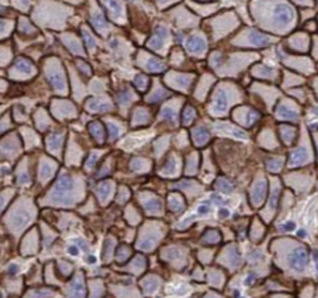 SGTA Antibody