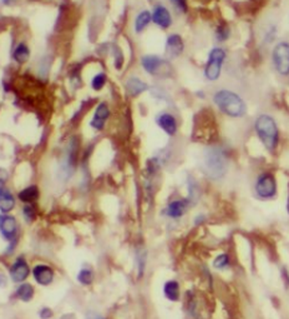 SIRPB1 Antibody