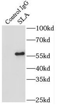 SEPSECS Antibody