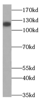SLC12A5 Antibody