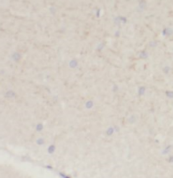 SLC12A5 Antibody
