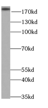 SLIT2 Antibody