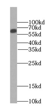 SMARCD1 Antibody