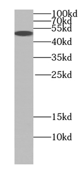 SMARCE1 Mouse Monoclonal Antibody