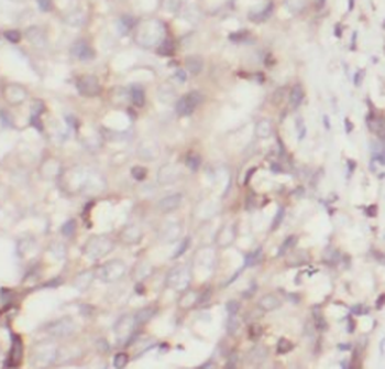 SMARCE1 Mouse Monoclonal Antibody
