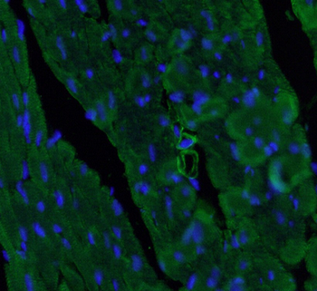 ACTA2 Antibody