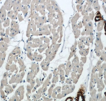 ACTA2 Antibody