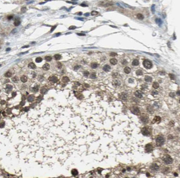 SMYD1 Antibody