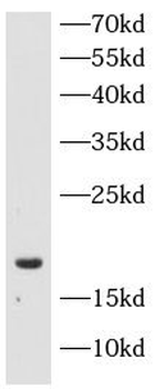 SST Rabbit Polyclonal Antibody