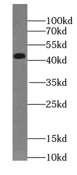 SUN5 Antibody