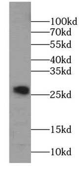 SPANXA1 Rabbit Polyclonal Antibody
